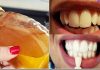 Diş Beyazlatma Nasıl Yapılır? - Sağlık - diş beyazlatma diş beyazlatma evde diş beyazlatma evde nasıl yapılır diş beyazlatma karbonat kalıcı diş beyazlatma
