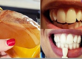 Diş Beyazlatma Nasıl Yapılır? - Sağlık - diş beyazlatma diş beyazlatma evde diş beyazlatma evde nasıl yapılır diş beyazlatma karbonat kalıcı diş beyazlatma