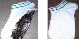 Beyaz Çorap Nasıl Temizlenir ?
